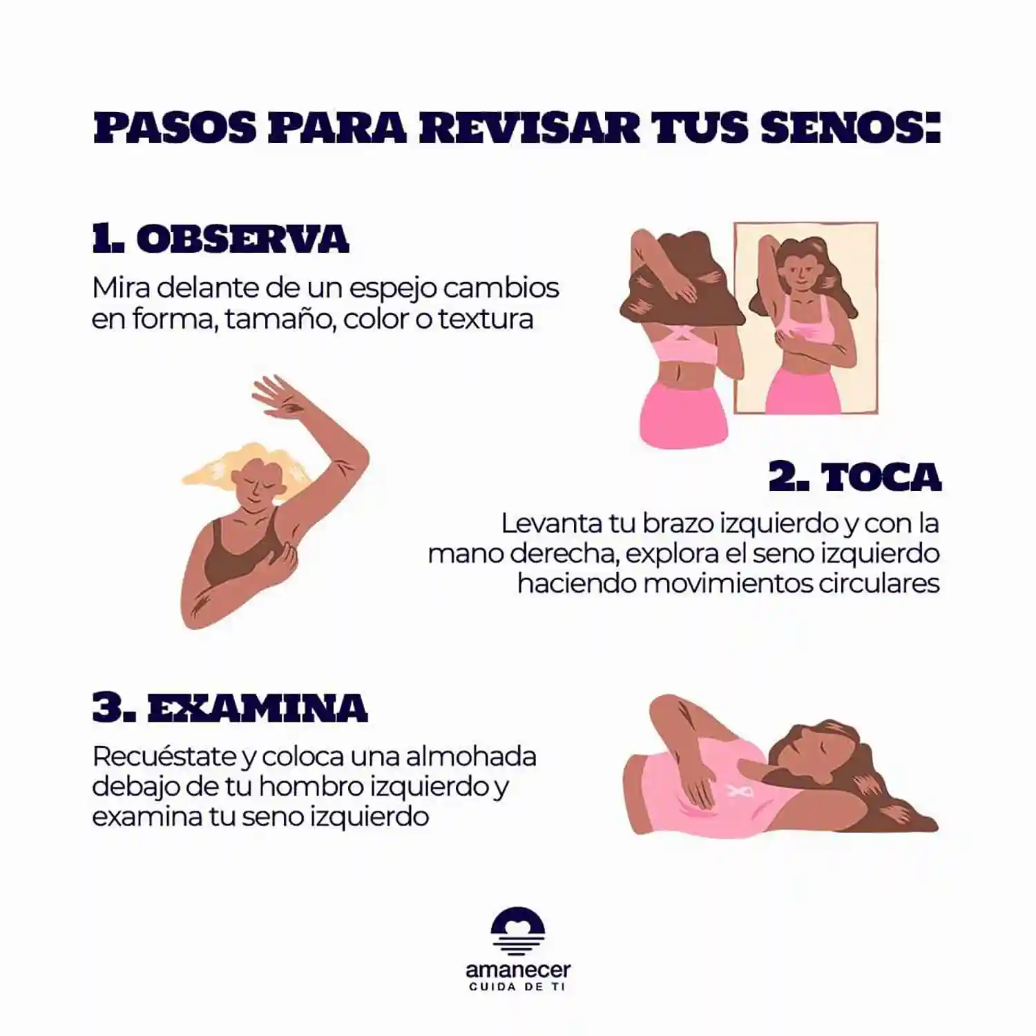 Prevención del Cáncer de Mama